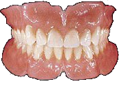 Dentures
